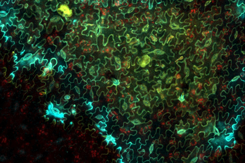 1_supresion_defensa_2